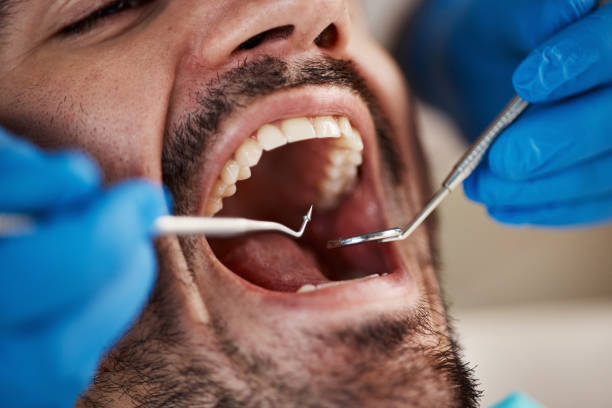 Best Emergency Dental Services for Seniors in Patrick Af, FL